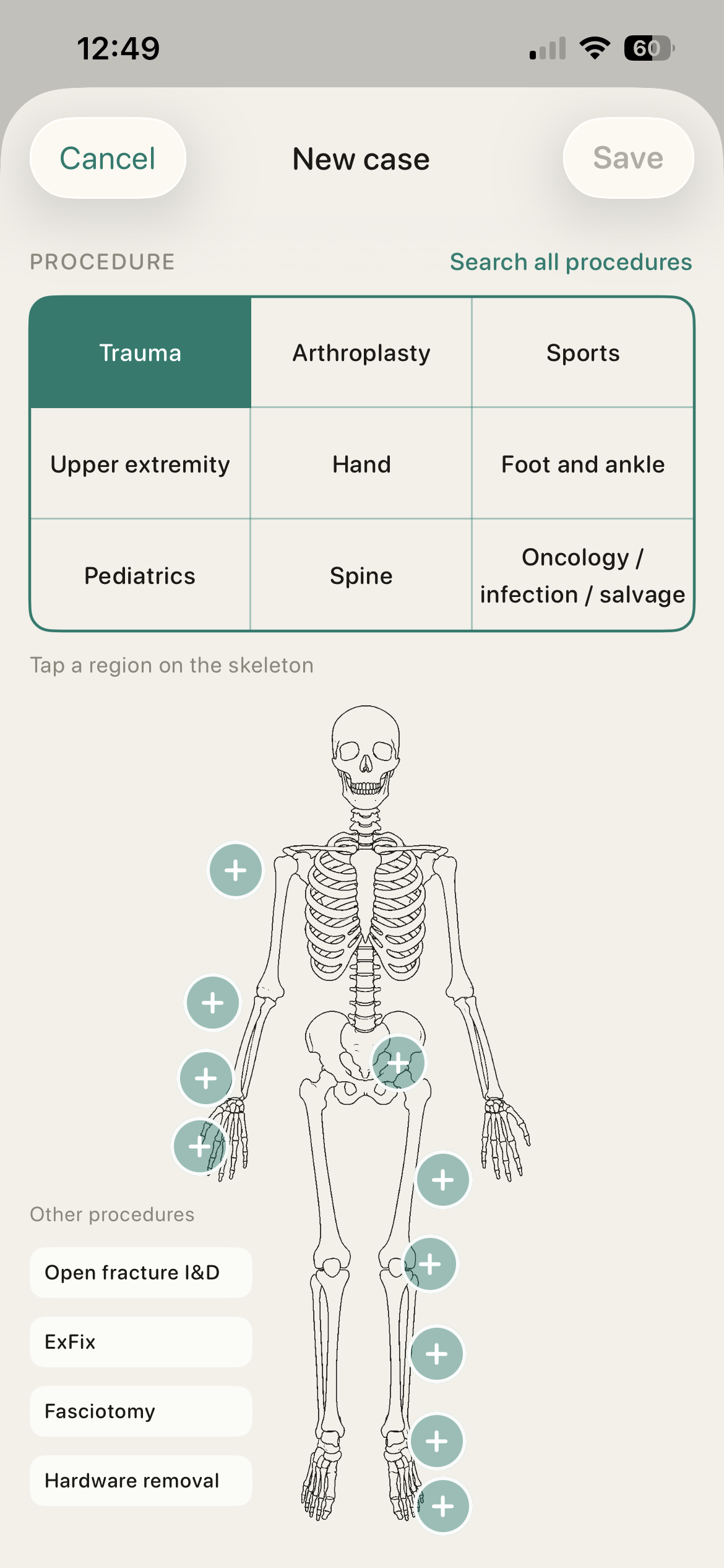 OrthoLog body map for finding a procedure