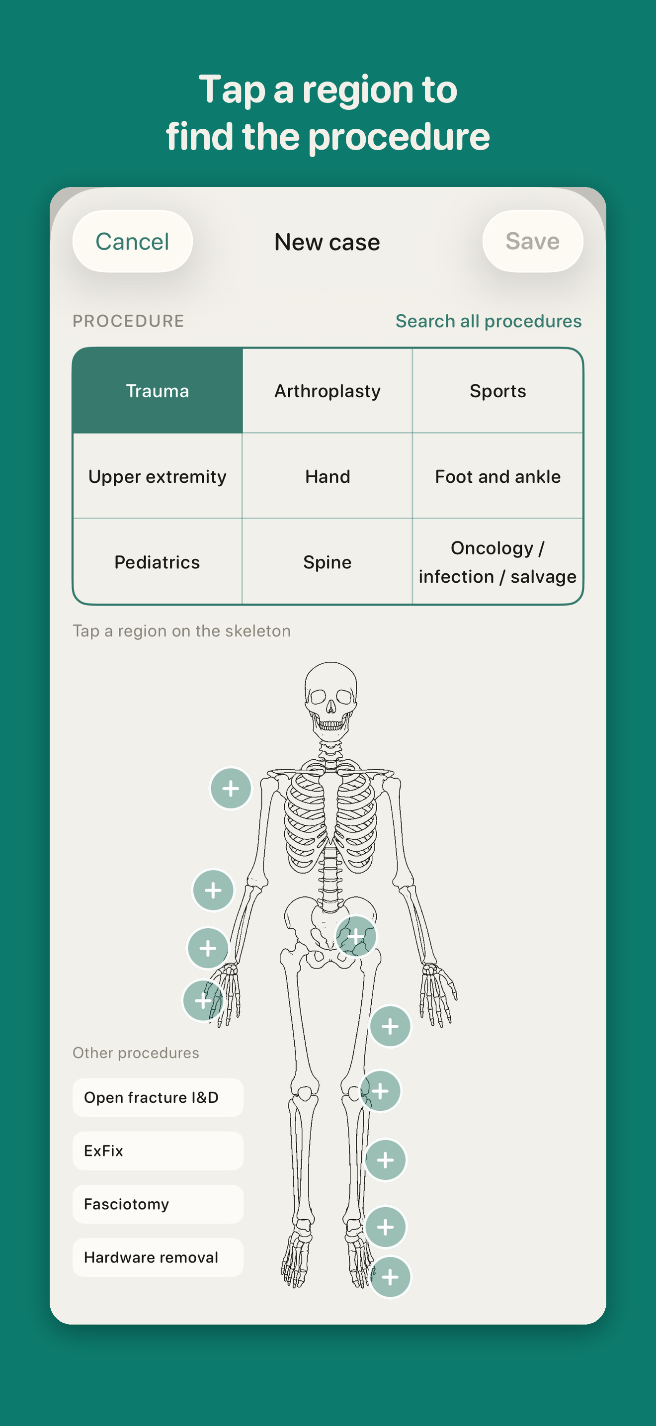 OrthoLog body map for finding a procedure